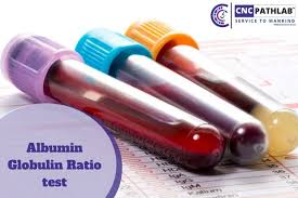 albumin globulin ratio